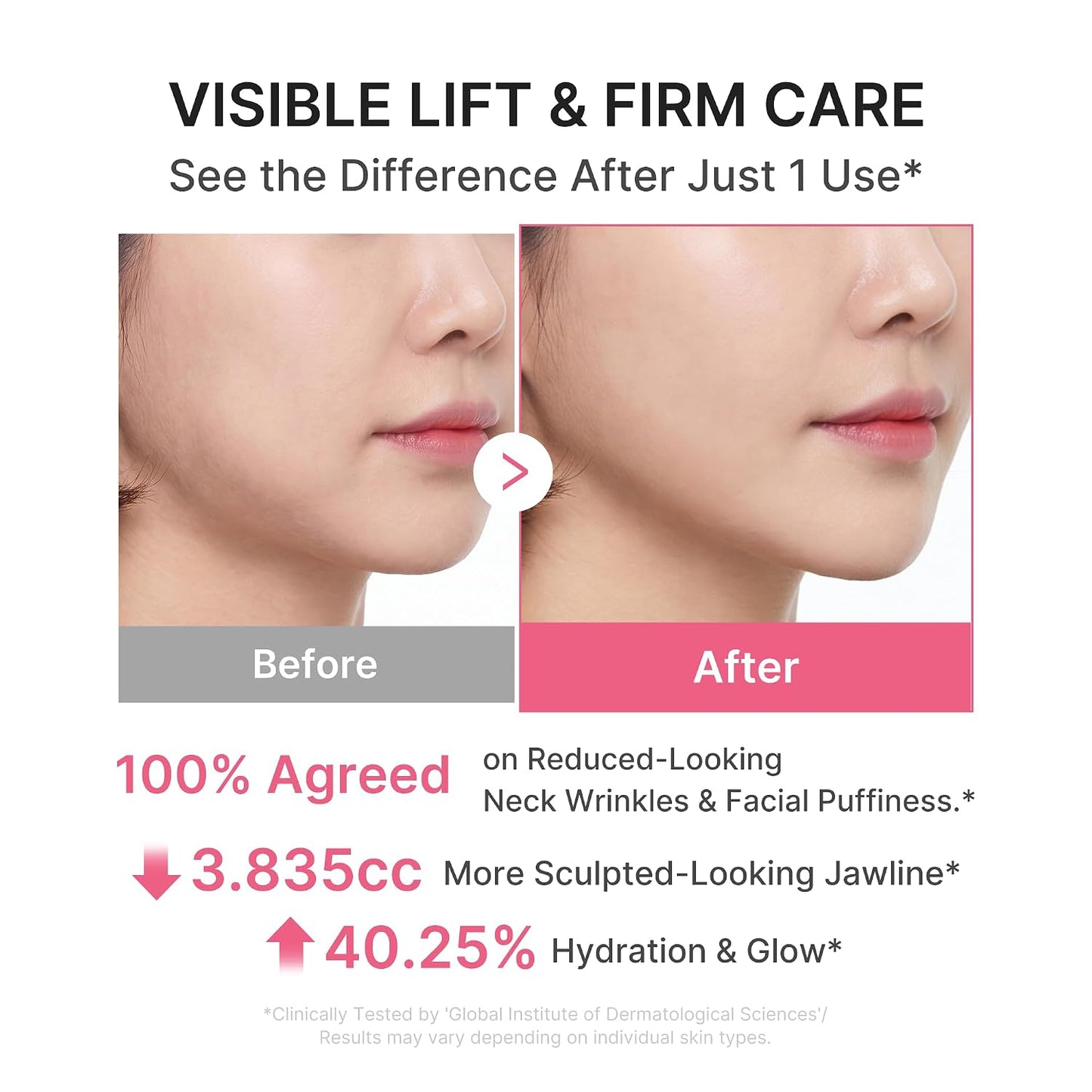 Medicube PDRN Collagen Gua Sha 5% Volufiline