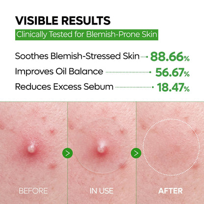 Dr.Melaxin S-ZINC ZERO-FIT Ultra Thin Blemish Spot Patch 0.013mm Invisible Pimple Stickers