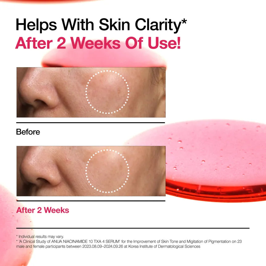 Anua Niacinamide 10+ TXA 4